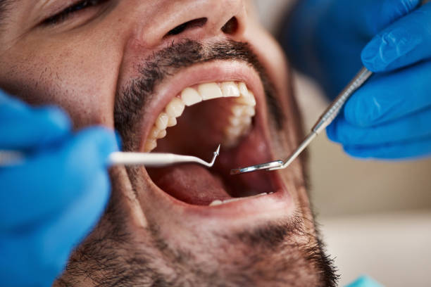 Best Dental Exams and Cleanings  in Echelon, NJ