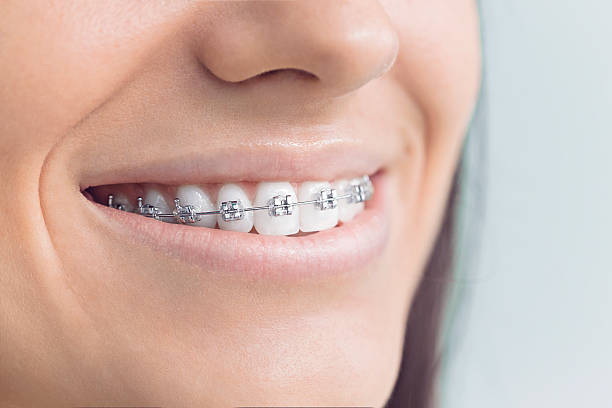 Best Dental Bonding  in Echelon, NJ